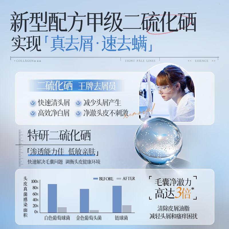 儒意二硫化硒净屑清爽洗发水500ml高清大图