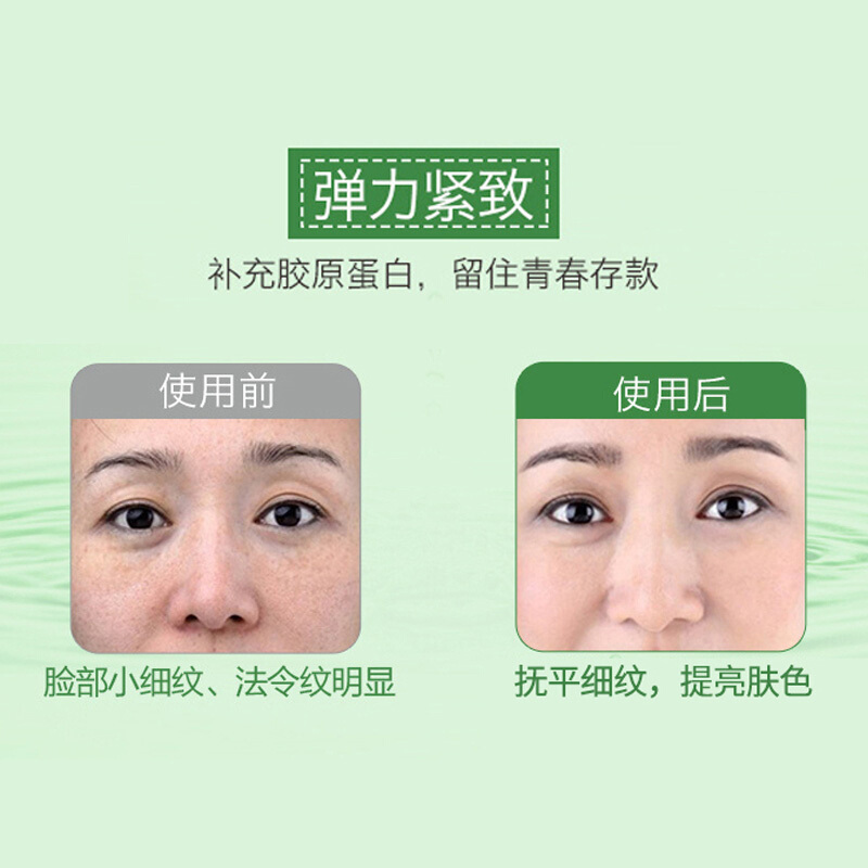 AHC 三代绿色高浓度胶原蛋白面膜面膜贴5片 提亮肤色 淡化黑色素 补水保湿 韩国正品进口