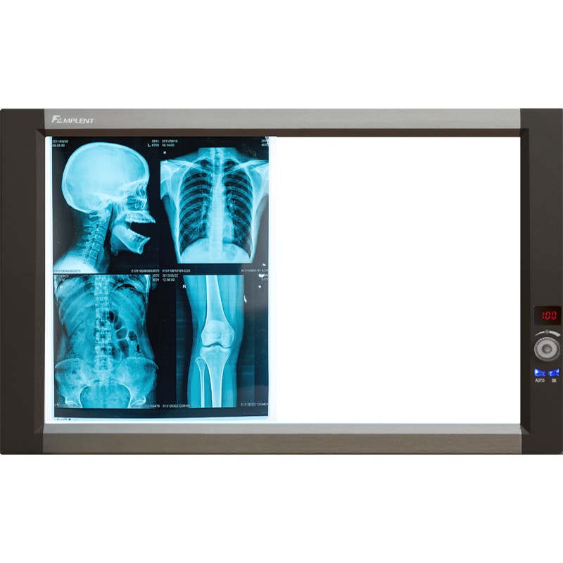 LED医用超薄液晶观片灯