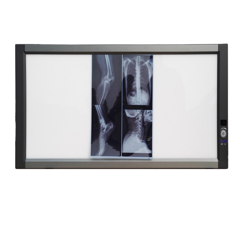 铭泰(MING TAI) 三联X8 LED医用超薄液晶观片 阅片区域1080×422