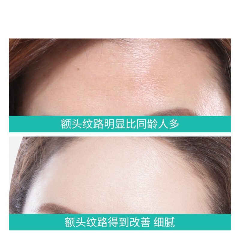 [2020抖音]胶原蛋白抗皱额头贴额头抗皱贴去抬头纹川字纹睡眠面膜男女额纹贴 5g*5片/盒