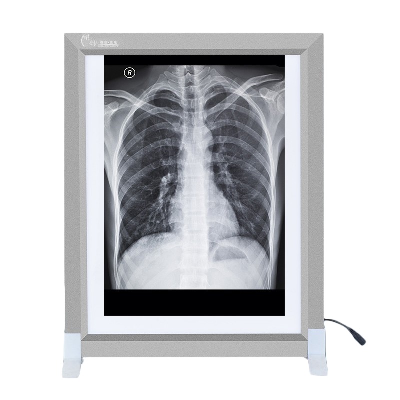 DP 远燕 YG-1A 观片灯 医用LED骨科x光观片灯箱