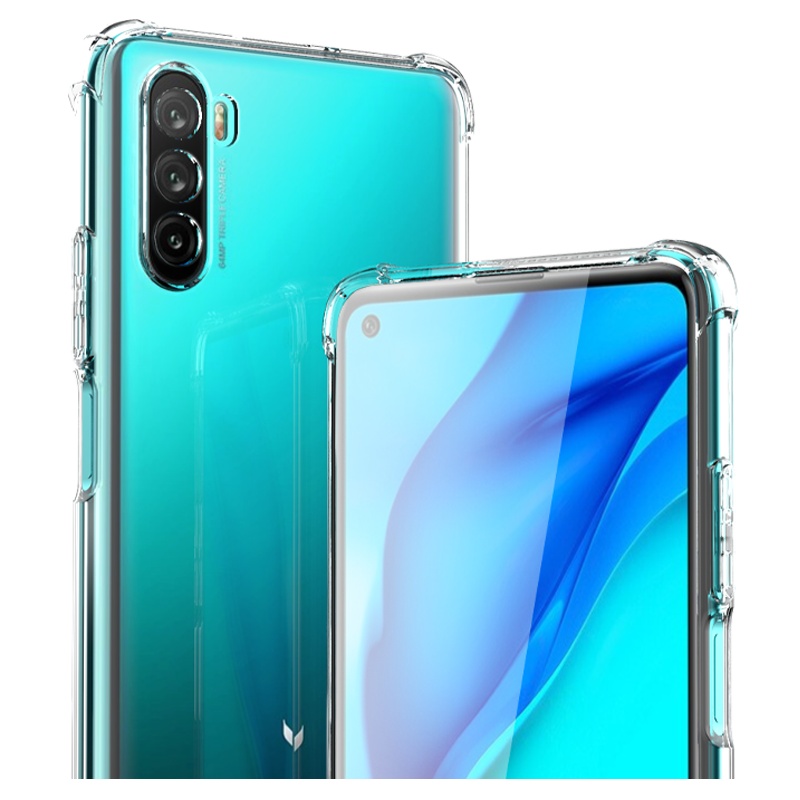 ESCASE 华为麦芒9手机壳保护套TPU全包气囊防摔壳男女通用透明软壳(有吊绳孔)ES-iP9系列 升级版透白